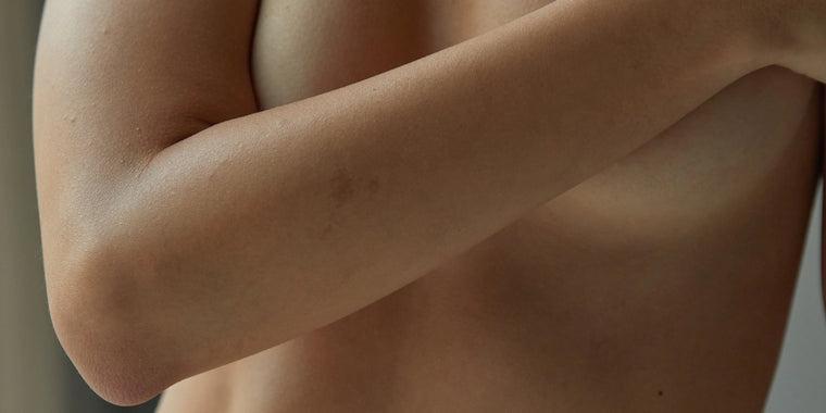 Eine Nahaufnahme des nackten Oberkörpers und Arms einer Person mit einem schwachen, kleinen Muttermal am Oberarm. Der Hintergrund ist sanft verschwommen.